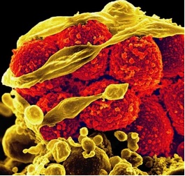 MSRA attacking human immune cells