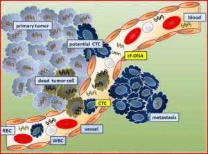 Figure 1. Primary tumor releases circulating tumor cells (CTCs) into the bloodstream. These CTCs are then able to metastasize, or spread of cancer cells, to distant areas.