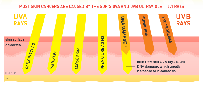 tanning bed skin damage