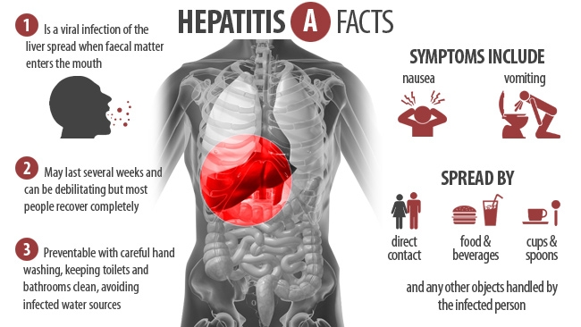 The Hepatitis A Outbreak: Highly Contagious Virus in the Jewel of ...