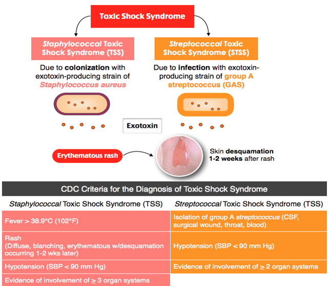 demystifying-toxic-shock-syndrome-sq-online