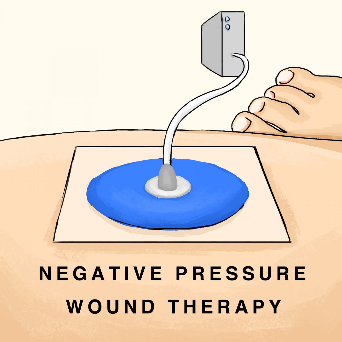 Skin Regeneration in Wound Healing: The Art of Self Preservation – SQ