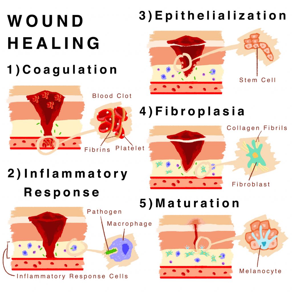 how-to-tell-if-a-wound-is-healing-or-infected-osf-healthcare