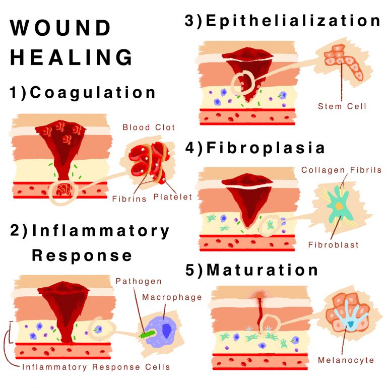 Skin Regeneration in Wound Healing: The Art of Self Preservation – SQ ...