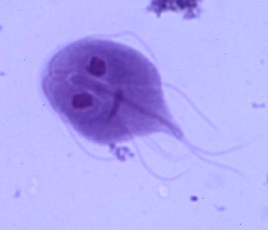 You’re Gonna Need a Better Water Filter: Giardia, Giardiasis, and Its